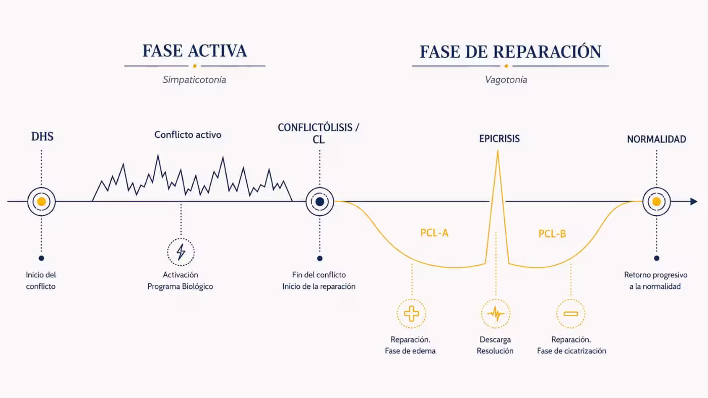 Esquema de la fase activa y la fase de reparación en Nueva Medicina Germánica con DHS, conflictólisis, crisis epileptoide y retorno a la normalidad.